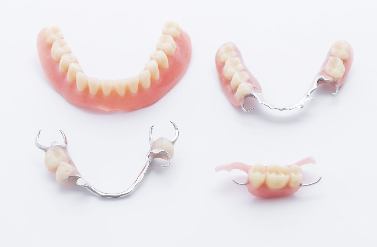 Zahnprothesen für fehlende Zähne