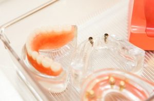 Mini-Zahnimplantate auf einem Tablett