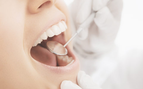 Eine Frau die mit Zahnprophylaxe behandelt wird