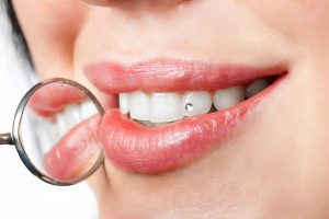 woman with white teeth with precious stone on it