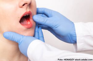 Der Zahnarzt untersucht den Biss eines Mädchens mit Zahnfleischerkrankung