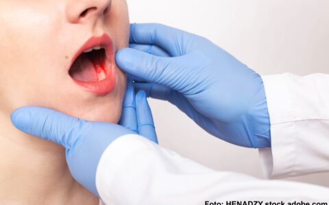 Der Zahnarzt untersucht den Biss eines Mädchens mit Zahnfleischerkrankung