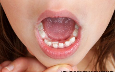 Durchbruch der Erwachsenen Zähne im Mund