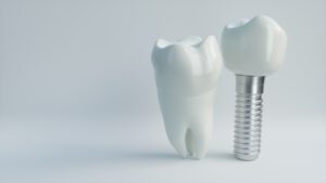 Zahnkrone, Implantat